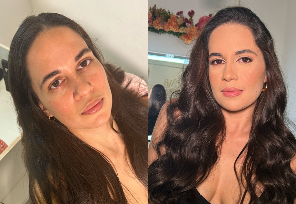 Antes e depois01