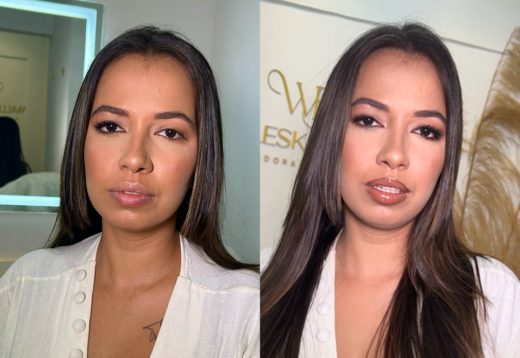Antes e depois02