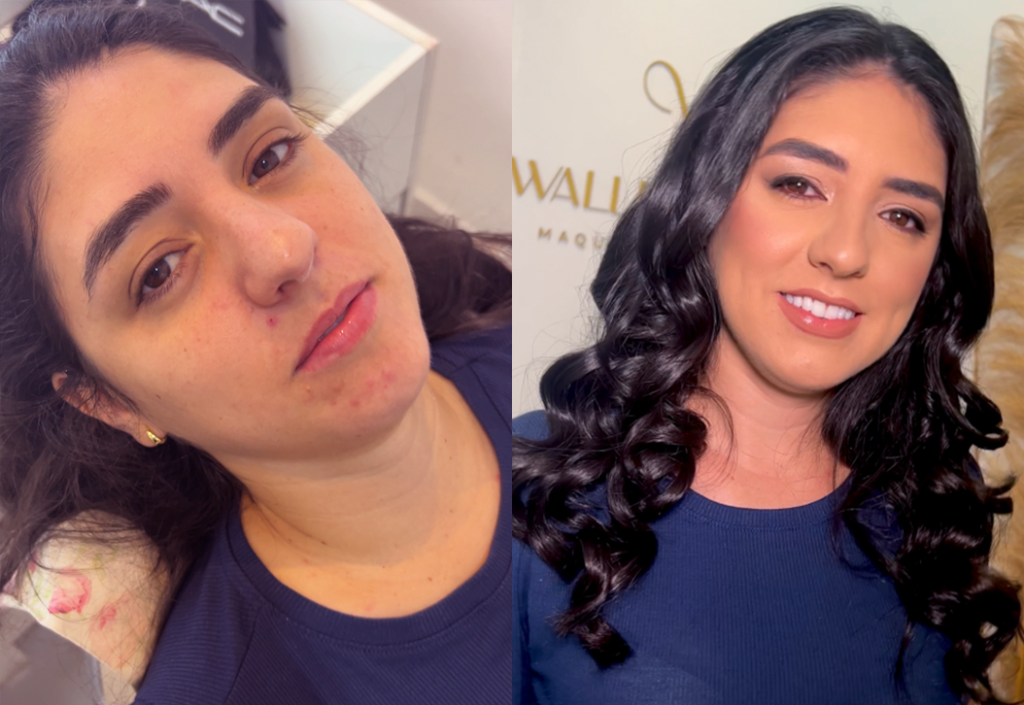 Antes e depois03